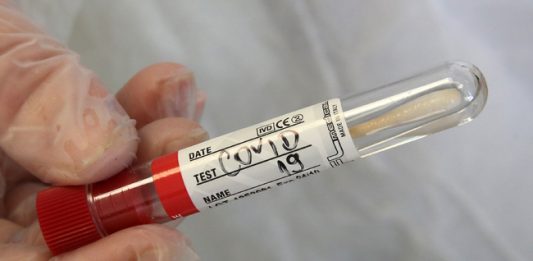 Новите случаи на коронавирус у нас за последното денонощие са 53, няма починали