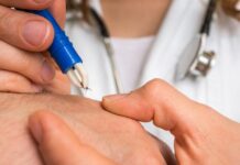 Внимание, кърлежи – как да се предпазим и какво да правим при ухапване