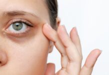 Четири начина да се отървете от торбичките под очите