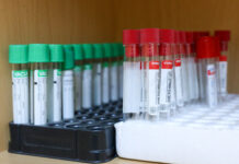 Въвеждат се временни противоепидемични мерки заради разпространението на коклюш