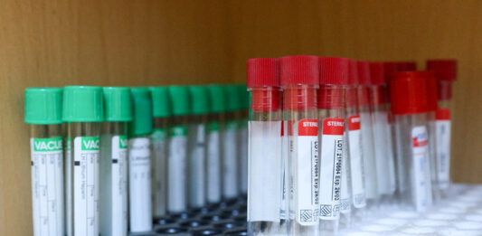 Въвеждат се временни противоепидемични мерки заради разпространението на коклюш