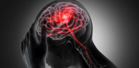 Храни, които увеличават риска от инсулт