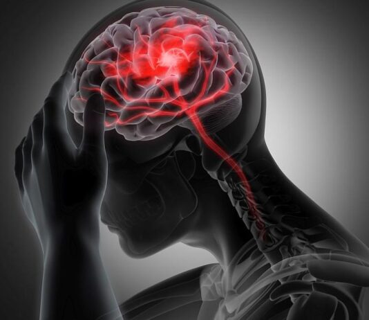 Храни, които увеличават риска от инсулт