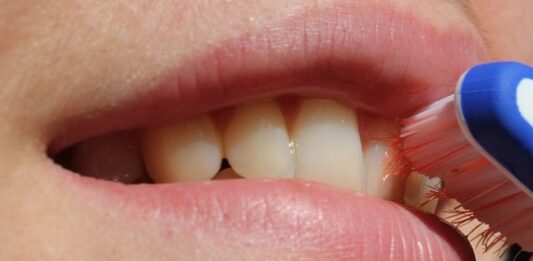 Учени установиха как с възрастта зъбите губят здравината си