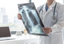 В сезона на пневмониите: Как да ги разпознаем