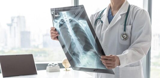 В сезона на пневмониите: Как да ги разпознаем