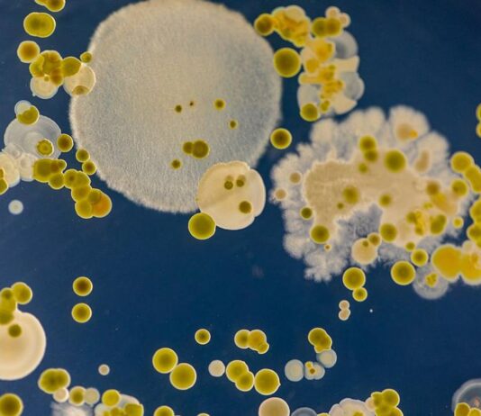 Парадокси в лечението с антибиотици и как губим битката срещу бактериите