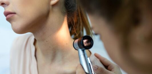 Разработиха нов крем, който помага на имунната система да се бори с рака на кожата