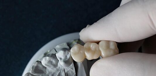 Меню от миналото: Зъбният емайл на древни хора разкрива детайли за храненето в Месопотамия